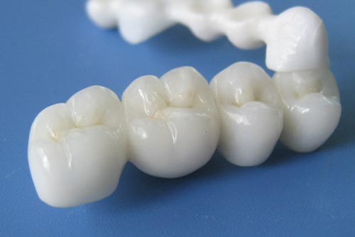 定制式活動(dòng)義齒醫(yī)療器械注冊(cè)證變更案例 定制式活動(dòng)義齒醫(yī)療器械注冊(cè)證變更案例